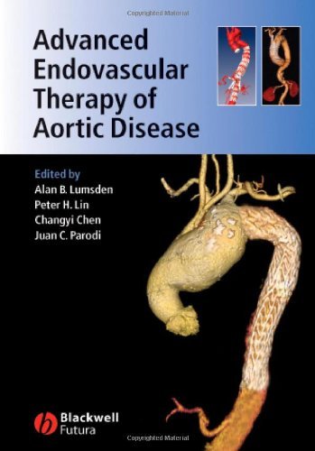 Alan B. Lumsden Advanced Endovascular Therapy Of Aortic Disease 