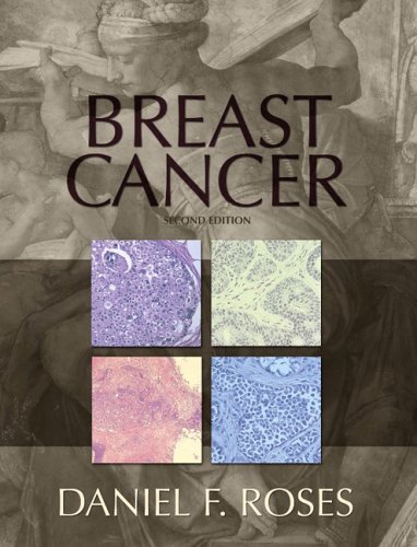 Daniel F. Roses Breast Cancer 0 Edition; 