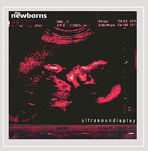 Newborns/Ultrasoundisplay