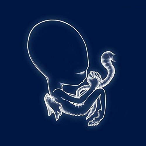 Sigur Rós/Agaetis Byrjun