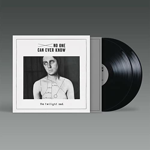 Twilight Sad No One Can Ever Know Amped Exclusive 