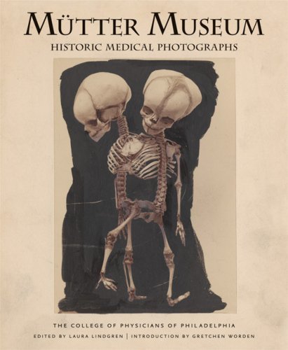 Laura Lindgren M?tter Museum Historic Medical Photographs 