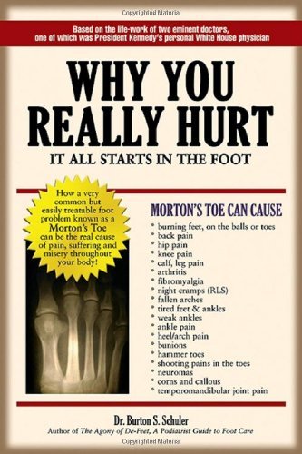 Burton S. Schuler Why You Really Hurt It All Starts In The Foot 