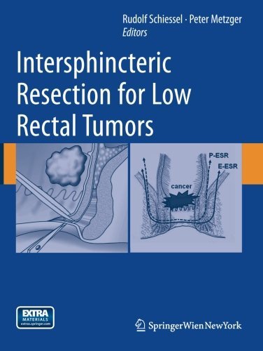 Rudolf Schiessel/Intersphincteric Resection for Low Rectal Tumors@2012
