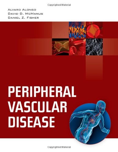 Alvaro Alonso Peripheral Vascular Disease 
