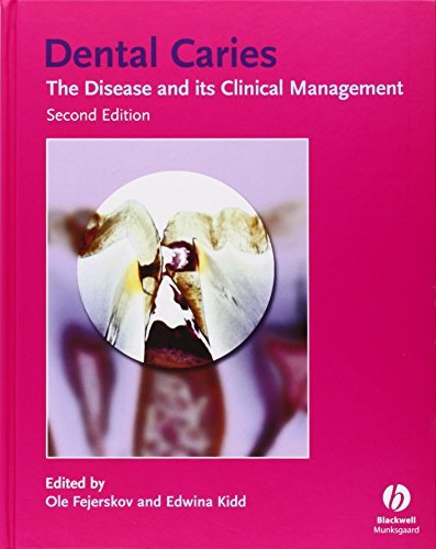 Ole Fejerskov Dental Caries The Disease And Its Clinical Management 0002 Edition; 