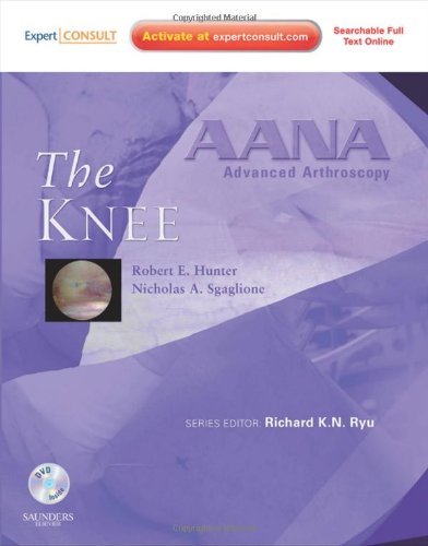 Robert E. Hunter The Knee [with Cdrom] 