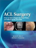 Bach Bernard R. Jr. Acl Surgery How To Get It Right The First Time And What To Do 