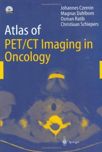 J. Czernin Atlas Of Pet Ct Imaging In Oncology 